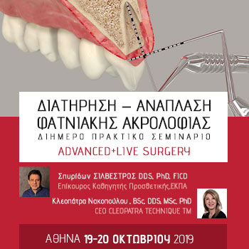 Διατήρηση – Ανάπλαση φατνιακής ακρολοφίας – Advanced + Live Surgery