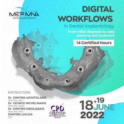 Digital workflows in Dental Implantology