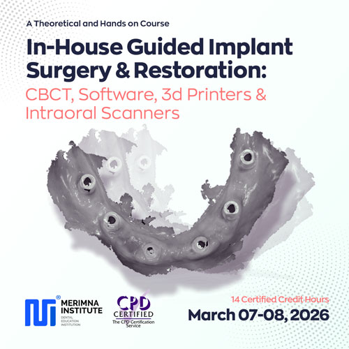 In-House Guided Implant Surgery & Restoration: CBCT, Software, 3d Printers & Intraoral Scanners