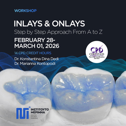 Inlays & Onlays – Step by Step Approach From A to Z